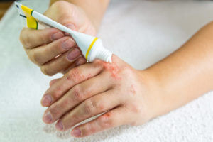 psoriasis treatment near me