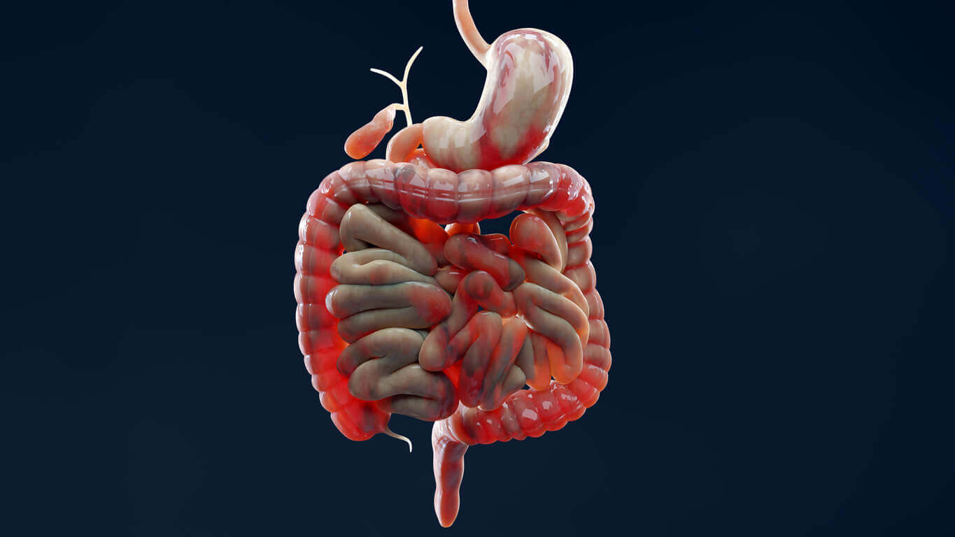 Man suffering from crohns disease inflamed large intestine