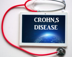 Crohns disease written on a tablet with a stethoscope wrapped around it.